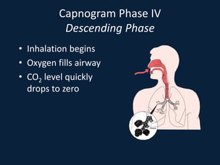 Capnogram Phase IV
Descending Phase
• Inhalation begins
• Oxygen fills airway
• CO2 level quickly
drops to zero
Alveoli
 