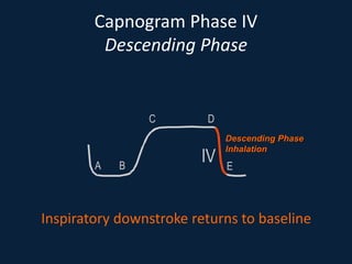 Capnogram Phase IV
Descending Phase
Inspiratory downstroke returns to baseline
A B
C D
E
IV
Descending Phase
Inhalation
 
