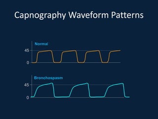 Capnography Waveform Patterns
45
0
Normal
Bronchospasm
45
0
 