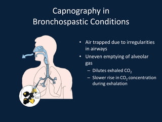 Capnography in
Bronchospastic Conditions
• Air trapped due to irregularities
in airways
• Uneven emptying of alveolar
gas
– Dilutes exhaled CO2
– Slower rise in CO2 concentration
during exhalation
Alveoli
 