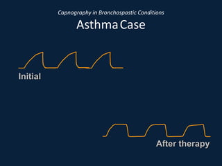 Capnography in Bronchospastic Conditions
AsthmaCase
Initial
After therapy
 