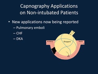 Capnography Applications
on Non-intubated Patients
• New applications now being reported
– Pulmonary emboli
– CHF
– DKA
r r O xy g e n
O 2
V e in
A te y
 