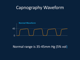 End tidal co2 and transcutaneous monitoring | PPTX
