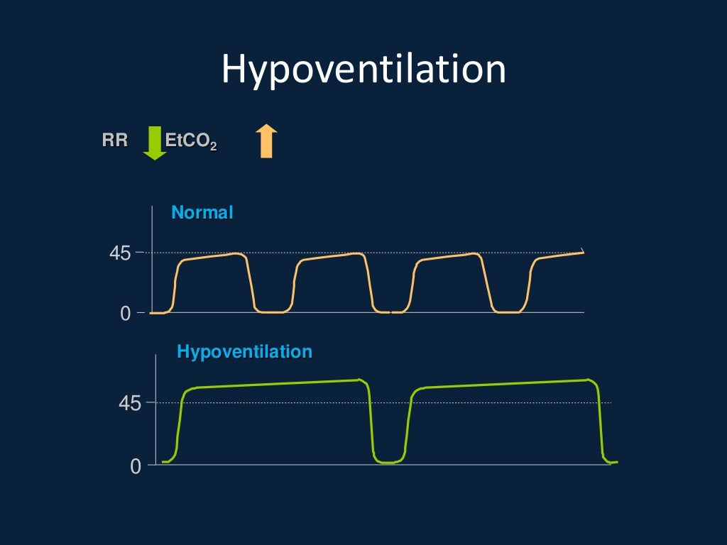 End tidal co2 and transcutaneous monitoring
