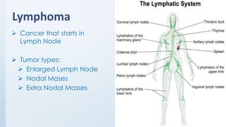 Lymphoma
➢ Cancer that starts in
Lymph Node
➢ Tumor types:
➢ Enlarged Lymph Node
➢ Nodal Mases
➢ Extra Nodal Masses
 