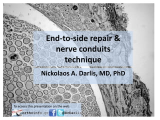 End-to-side repair &
nerve conduits
technique
Nickolaos A. Darlis, MD, PhD
To access this presentation on the web:
 