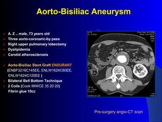 v A. Z ., male, 73 years old
v Three aorto-coronaric-by pass
v Right upper pulmonary lobectomy
v Dyslipidemia
v Carotid atherosclerosis
v Aorto-Bisiliac Stent Graft ENDURANT
(ENBF3216C145EE, ENLW1624C80EE,
ENLW1624C120EE )
v Bilateral Bell Bottom Technique
v 2 Coils (Cook IMWCE 35 20 20)
Fibrin glue 10cc
Pre-surgery angio-CT scan
Aorto-Bisiliac AneurysmAorto-Bisiliac Aneurysm
 