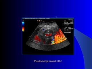 Pre-discharge control CDU
 