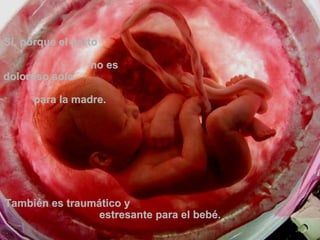 Si, porque el parto  no es doloroso solo  para la madre.   También es traumático y  estresante para el bebé. 