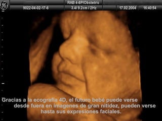 Gracias a la ecografía 4D, el futuro bebé puede verse  desde fuera en imagenes de gran nitidez, pueden verse  hasta sus expresiones faciales. 