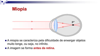 Miopia
 A miopia se caracteriza pela dificuldade de enxergar objetos
muito longe, ou seja, no infinito.
 A imagem se forma antes da retina.
 