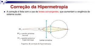 Correção da Hipermetropia
 A correção é feita com o uso de lentes convergentes, que aumentam a vergência do
sistema ocular:
 