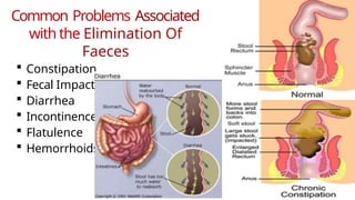 Common Problems Associated
with the Elimination Of
Faeces
 Constipation
 Fecal Impaction
 Diarrhea
 Incontinence
 Flatulence
 Hemorrhoids
 