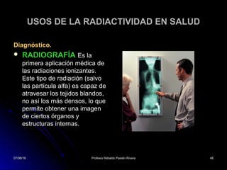 07/06/1607/06/16 Profesor Nibaldo Pastén RiveraProfesor Nibaldo Pastén Rivera 4848
USOS DE LA RADIACTIVIDAD EN SALUD
Diagnóstico.
 RADIOGRAFÍA Es la
primera aplicación médica de
las radiaciones ionizantes.
Este tipo de radiación (salvo
las partícula alfa) es capaz de
atravesar los tejidos blandos,
no así los más densos, lo que
permite obtener una imagen
de ciertos órganos y
estructuras internas.
07/06/1607/06/16 4848
 