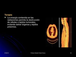 07/06/1607/06/16 Profesor Nibaldo Pastén RiveraProfesor Nibaldo Pastén Rivera 5252
Terapia
 La energía contenida en las
radiaciones permite la destrucción
de células o tejidos tumorales,
evitando dañar órganos y tejidos
próximos.
07/06/1607/06/16 5252
 