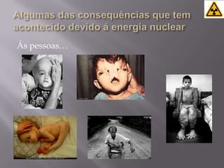 Algumas das consequências que tem acontecido devido á energia nuclear Ás pessoas…