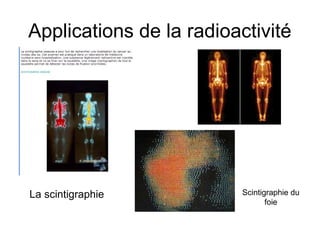 Applications de la radioactivité
La scintigraphie Scintigraphie du
foie
 