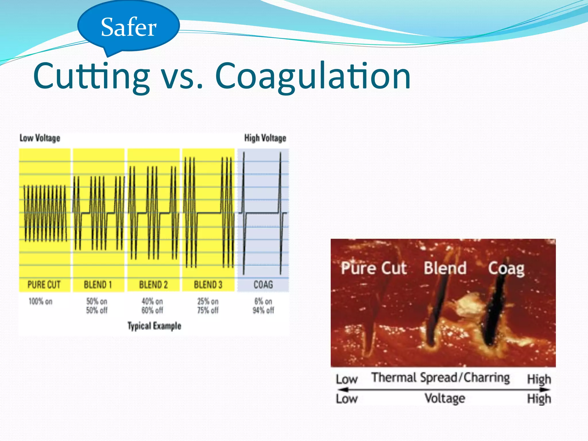 CuIng	
  vs.	
  Coagula;on	
  
Safer	
  
 
