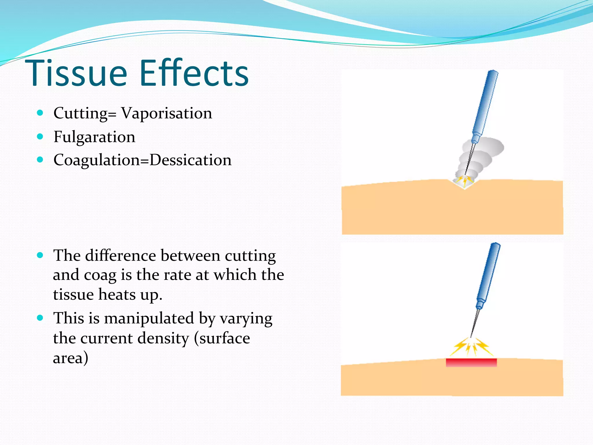Tissue	
  Eﬀects	
  
—  Cutting=	
  Vaporisation	
  
—  Fulgaration	
  
—  Coagulation=Dessication	
  
—  The	
  diﬀerence	
  between	
  cutting	
  
and	
  coag	
  is	
  the	
  rate	
  at	
  which	
  the	
  
tissue	
  heats	
  up.	
  
—  This	
  is	
  manipulated	
  by	
  varying	
  
the	
  current	
  density	
  (surface	
  
area)	
  
 