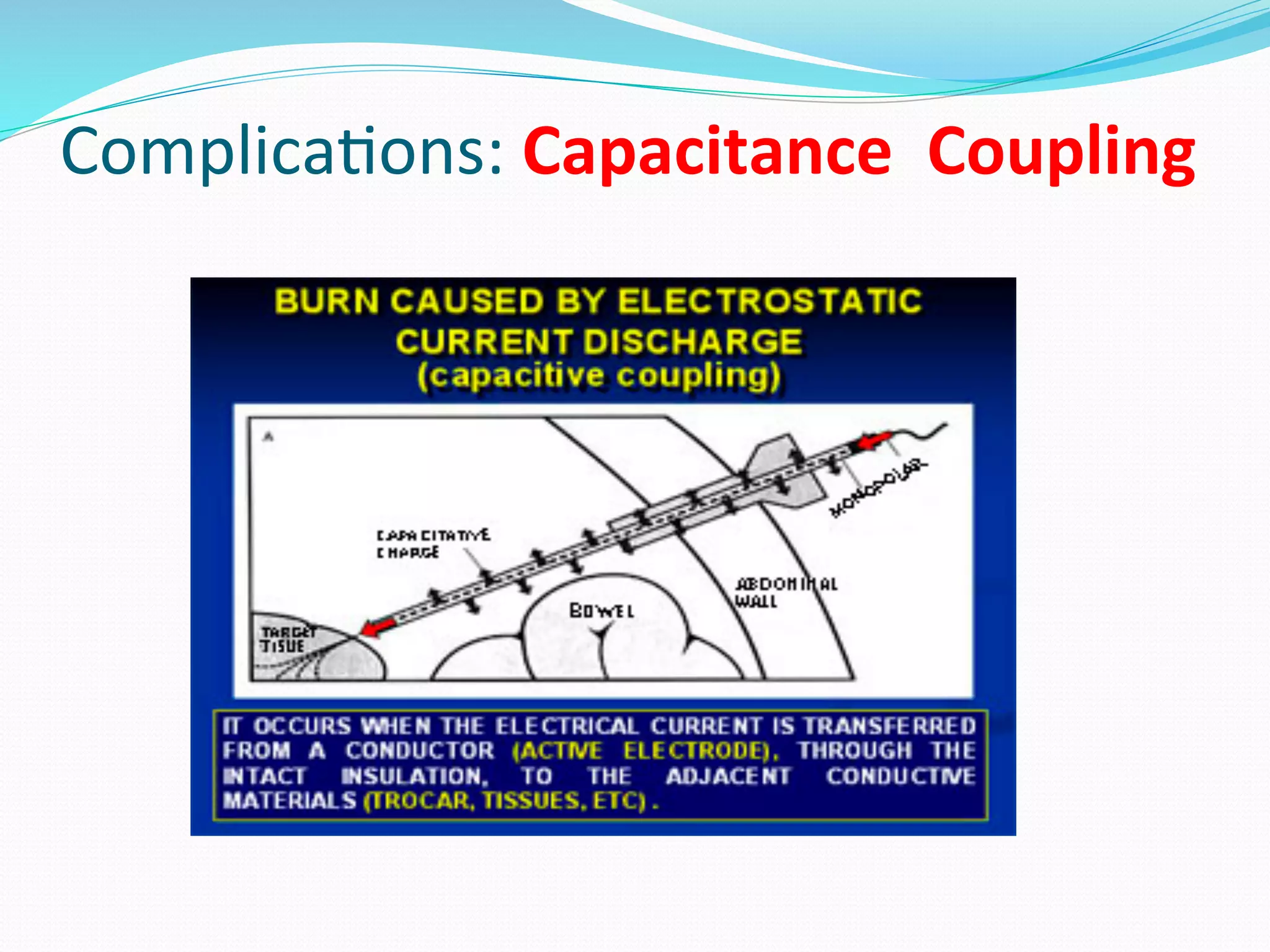 Complica;ons:	
  Capacitance	
  	
  Coupling	
  
 