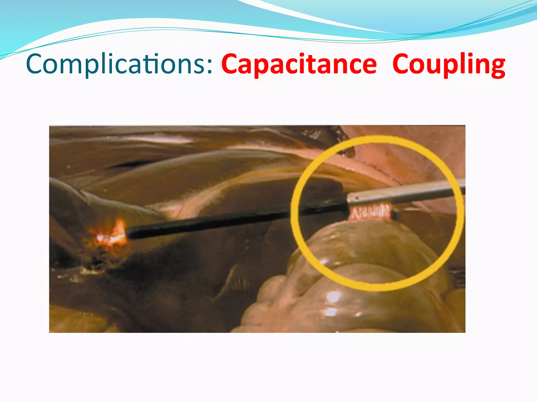 Complica;ons:	
  Capacitance	
  	
  Coupling	
  
 