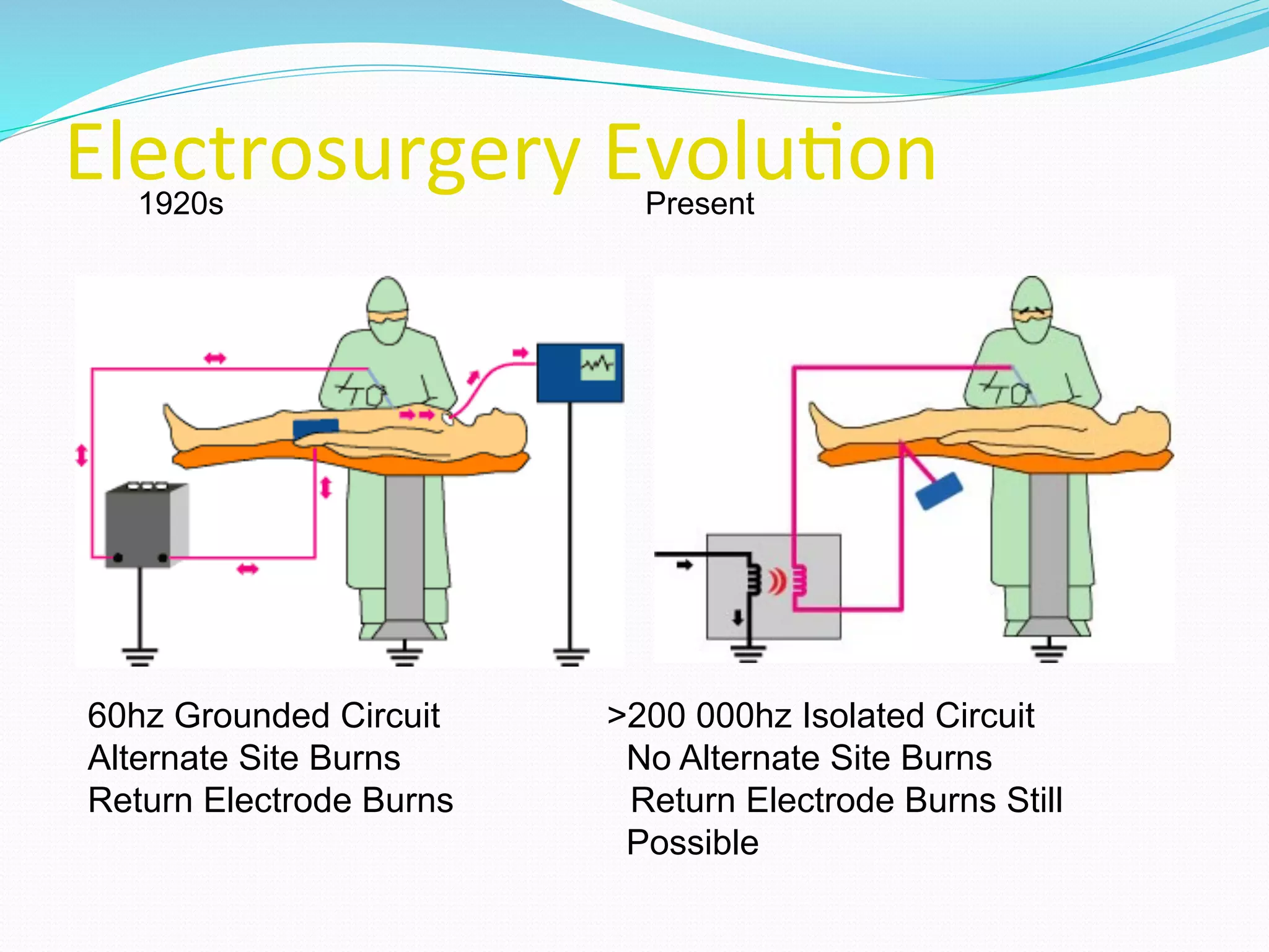 Electrosurgery	
  Evolu;on	
  
	
  
	
  
1920s Present
60hz Grounded Circuit >200 000hz Isolated Circuit
Alternate Site Burns No Alternate Site Burns
Return Electrode Burns Return Electrode Burns Still
Possible
 