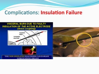 Energy Isolation Failures Energy sources jb | PDF
