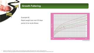 Growth Faltering Pattern Energy nutrient-dense formula in critically ill | PPTX