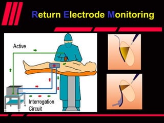 RReturneturn EElectrodelectrode MMonitoringonitoring
 