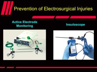 Prevention of Electrosurgical Injuries
Active Electrode
Monitoring Insuloscope
 