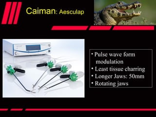 Caiman: Aesculap
• Pulse wave form
modulation
• Least tissue charring
• Longer Jaws: 50mm
• Rotating jaws
 