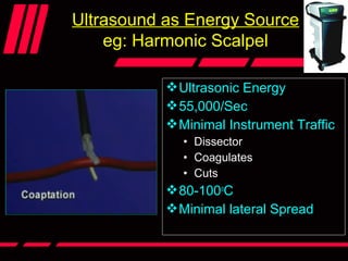 Ultrasound as Energy Source
eg: Harmonic Scalpel
Ultrasonic Energy
55,000/Sec
Minimal Instrument Traffic
• Dissector
• Coagulates
• Cuts
80-100o
C
Minimal lateral Spread
 