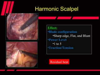 Harmonic Scalpel
Effect:
•Blade configuration
•Sharp edge, Flat, and Blunt
•Power Level
•1 to 5
•Traction/Tension
Residual heat
 