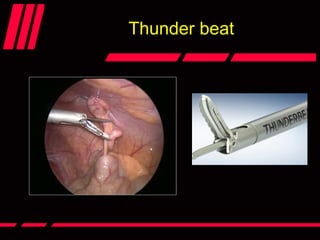 Thunder beat
 