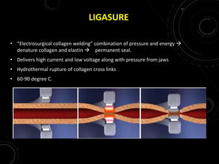 LIGASURE
• “Electrosurgical collagen welding” combination of pressure and energy 
denature collagen and elastin  permanent seal.
• Delivers high current and low voltage along with pressure from jaws
• Hydrothermal rupture of collagen cross links
• 60-90 degree C.
 