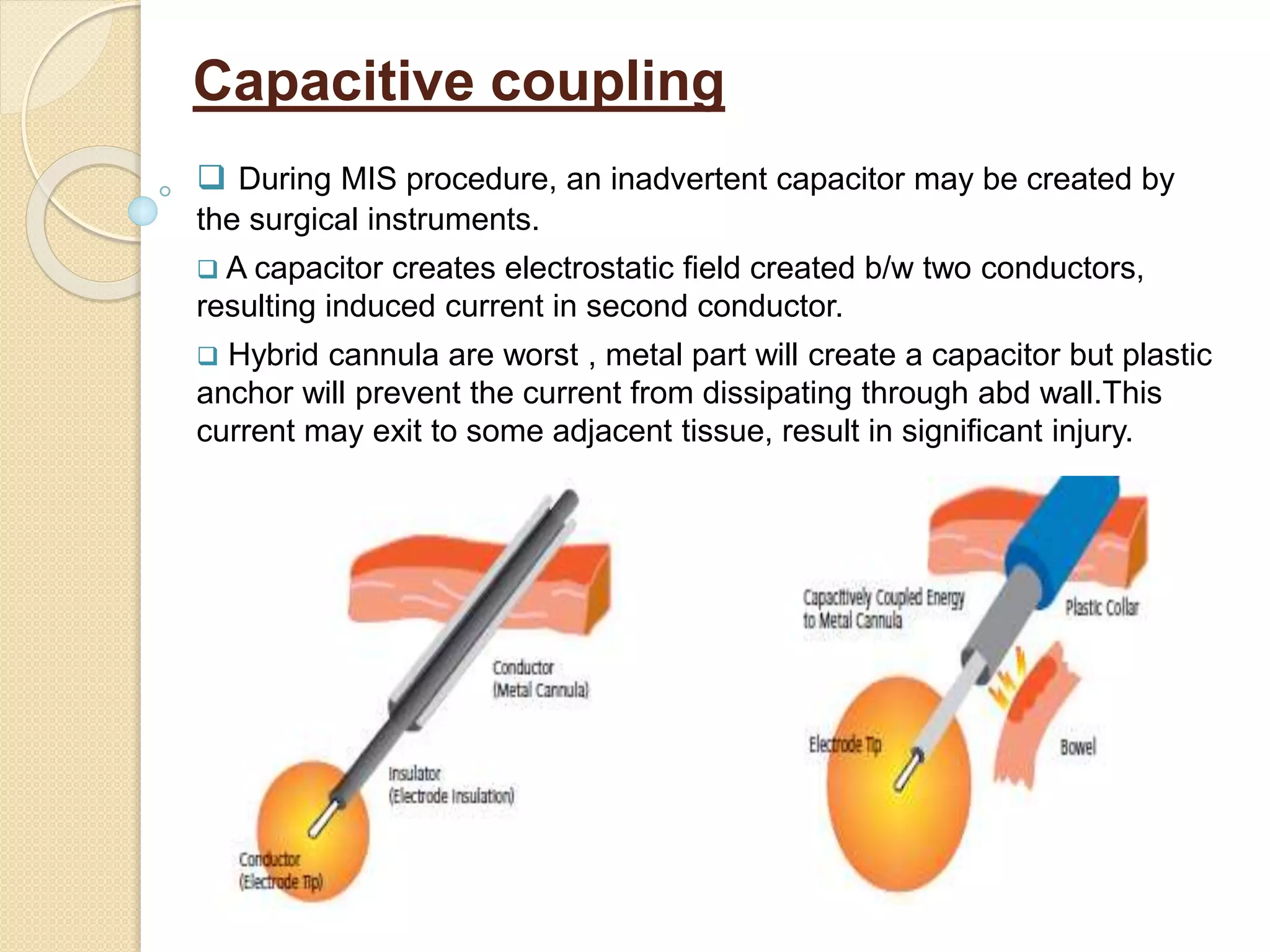 Capacitive coupling
 During MIS procedure, an inadvertent capacitor may be created by
the surgical instruments.
 A capacitor creates electrostatic field created b/w two conductors,
resulting induced current in second conductor.
 Hybrid cannula are worst , metal part will create a capacitor but plastic
anchor will prevent the current from dissipating through abd wall.This
current may exit to some adjacent tissue, result in significant injury.
 