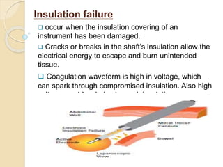 Energy Isolation Failures Energy sources in surgery | PPTX