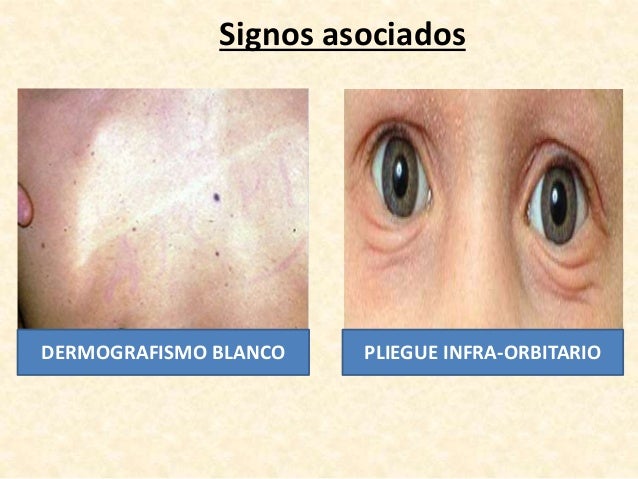 Como curar la psoriasis de nutri