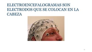 ELECTROENCEFALOGRAMAS SON
ELECTRODOS QUE SE COLOCAN EN LA
CABEZA
43
 