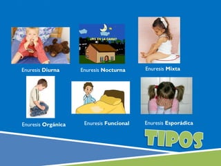 Enuresis Diurna     Enuresis Nocturna     Enuresis Mixta




Enuresis Orgánica    Enuresis Funcional   Enuresis Esporádica
 