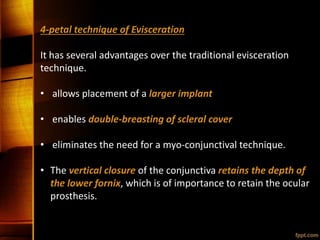 4-petal technique of Evisceration
It has several advantages over the traditional evisceration
technique.
• allows placement of a larger implant
• enables double-breasting of scleral cover
• eliminates the need for a myo-conjunctival technique.
• The vertical closure of the conjunctiva retains the depth of
the lower fornix, which is of importance to retain the ocular
prosthesis.
 