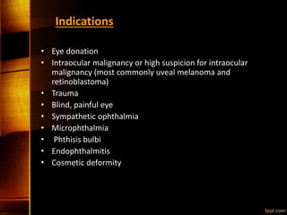 Indications
• Eye donation
• Intraocular malignancy or high suspicion for intraocular
malignancy (most commonly uveal melanoma and
retinoblastoma)
• Trauma
• Blind, painful eye
• Sympathetic ophthalmia
• Microphthalmia
• Phthisis bulbi
• Endophthalmitis
• Cosmetic deformity
 