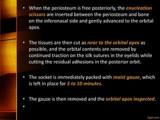 • When the periosteum is free posteriorly, the enucleation
scissors are inserted between the periosteum and bone
on the inferonasal side and gently advanced to the orbital
apex.
• The tissues are then cut as near to the orbital apex as
possible, and the orbital contents are removed by
continued traction on the silk sutures in the eyelids while
cutting the residual adhesions in the posterior orbit.
• The socket is immediately packed with moist gauze, which
is left in place for 5 to 10 minutes.
• The gauze is then removed and the orbital apex inspected.
•
 
