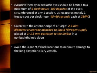 • cyclocryotherapy in pediatric eyes should be limited to a
maximum of 6 clock hours (180 degrees of the eye's
circumference) at any 1 session, using approximately 1
freeze-spot per clock-hour (45–60 seconds each at 280ºC)
• Given with the anterior edge of a "large" 2.5-mm
diameter cryoprobe attached to liquid Nitrogen supply
placed at 1–1.5 mm posterior to the limbus in a
nonbuphthalmic globe
• avoid the 3 and 9 o'clock locations to minimize damage to
the long posterior ciliary vessels.
 