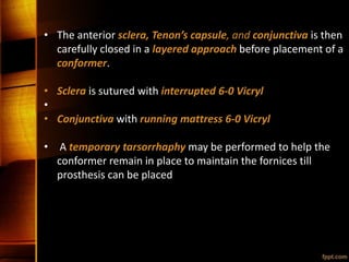 • The anterior sclera, Tenon’s capsule, and conjunctiva is then
carefully closed in a layered approach before placement of a
conformer.
• Sclera is sutured with interrupted 6-0 Vicryl
•
• Conjunctiva with running mattress 6-0 Vicryl
• A temporary tarsorrhaphy may be performed to help the
conformer remain in place to maintain the fornices till
prosthesis can be placed
 
