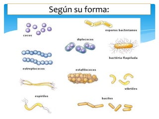 Según su forma:

 
