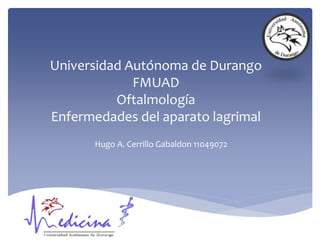 Universidad Autónoma de Durango
FMUAD
Oftalmología
Enfermedades del aparato lagrimal
Hugo A. Cerrillo Gabaldon 11049072
 
