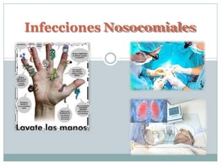 Infecciones Nosocomiales
 