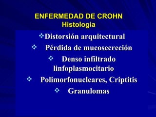 ENFERMEDAD DE CROHN Histologia Distorsión arquitectural Pérdida de mucosecreción Denso infiltrado linfoplasmocitario  Polimorfonucleares, Criptitis Granulomas 