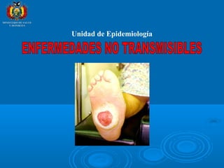 Unidad de Epidemiología
MINISTERIO DE SALUDMINISTERIO DE SALUD
Y DEPORTESY DEPORTES
 